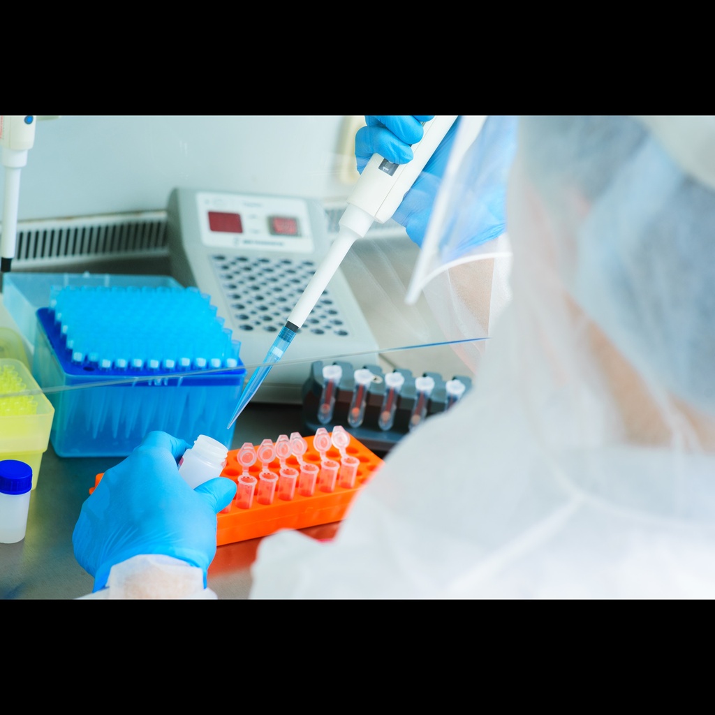 HantaVirus Renal Syndrome Type II Real Time RTsize:PCR Kit size: 25 reactions